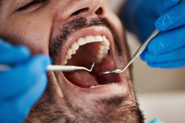 Best Same-Day Emergency Dental Services in Cape Carteret, NC